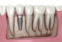 Kallangur Dental Suite image 6